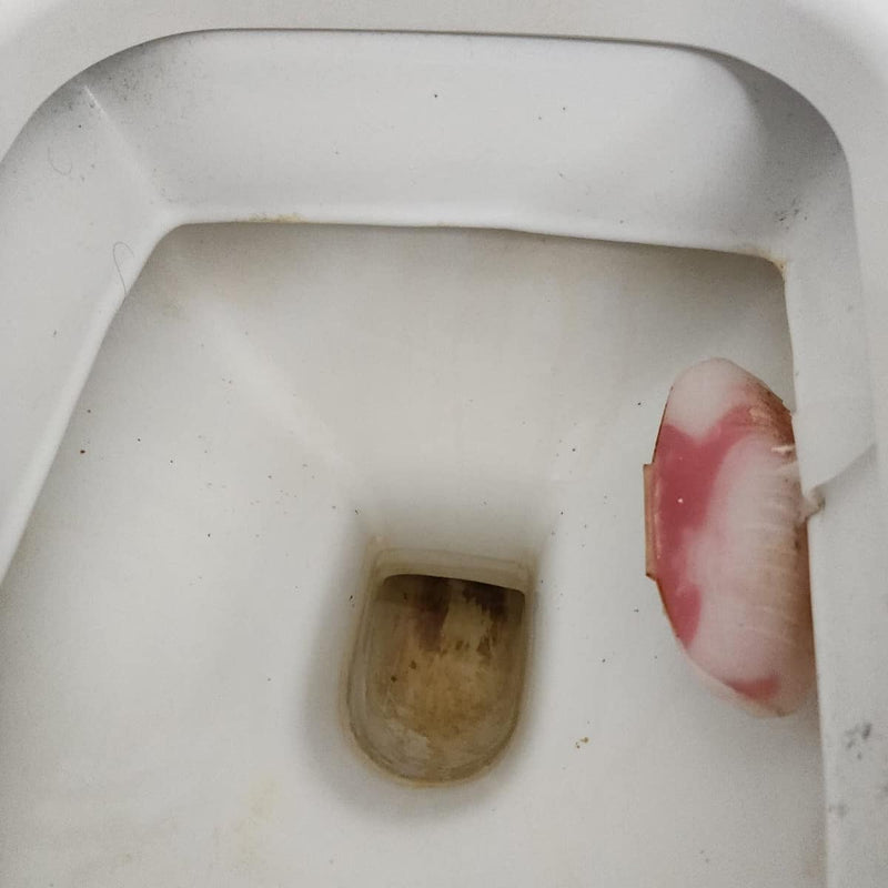 אבנית ולכלוך קשה באסלה? חומר אחד והיא כמו חדשה!